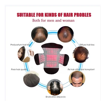 Plaukų Pro Augimo Sistema, 100 Diodai Plaukų Slinkimas Gydymo Bžūp Vyrams ir Moterims, Atkurti Terapijos Prietaisas